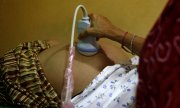 Echographie pratiquée dans une clinique pour mères porteuses à Anand, en Inde. (© picture alliance / EIDON / MAXPPP / Donatella Giagnori)